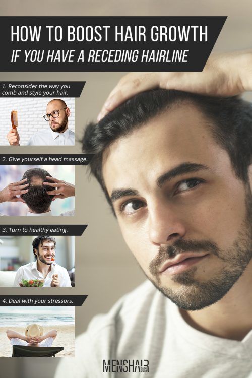 Receding Hairline Treatment Guidelines Prevent Resolve And