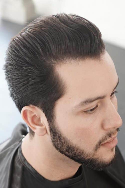 Receding Hairline Treatment Guidelines Prevent Resolve And