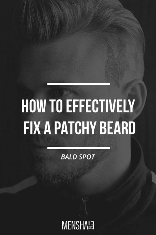 Find The Remedy To A Patchy Beard Here