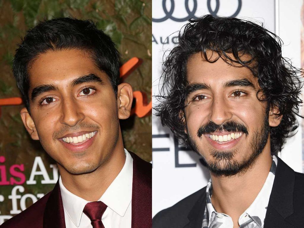 Dev Patel #facialhair #beard #beardtranformation