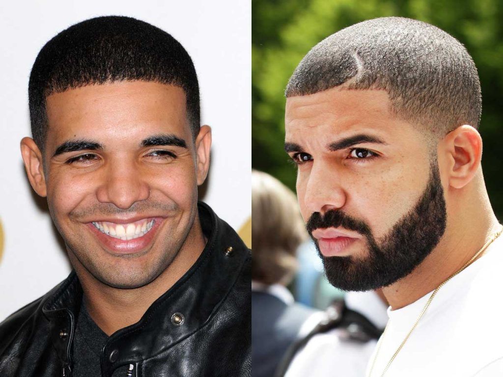 Drake #drake #facialhair #beard #beardtranformation