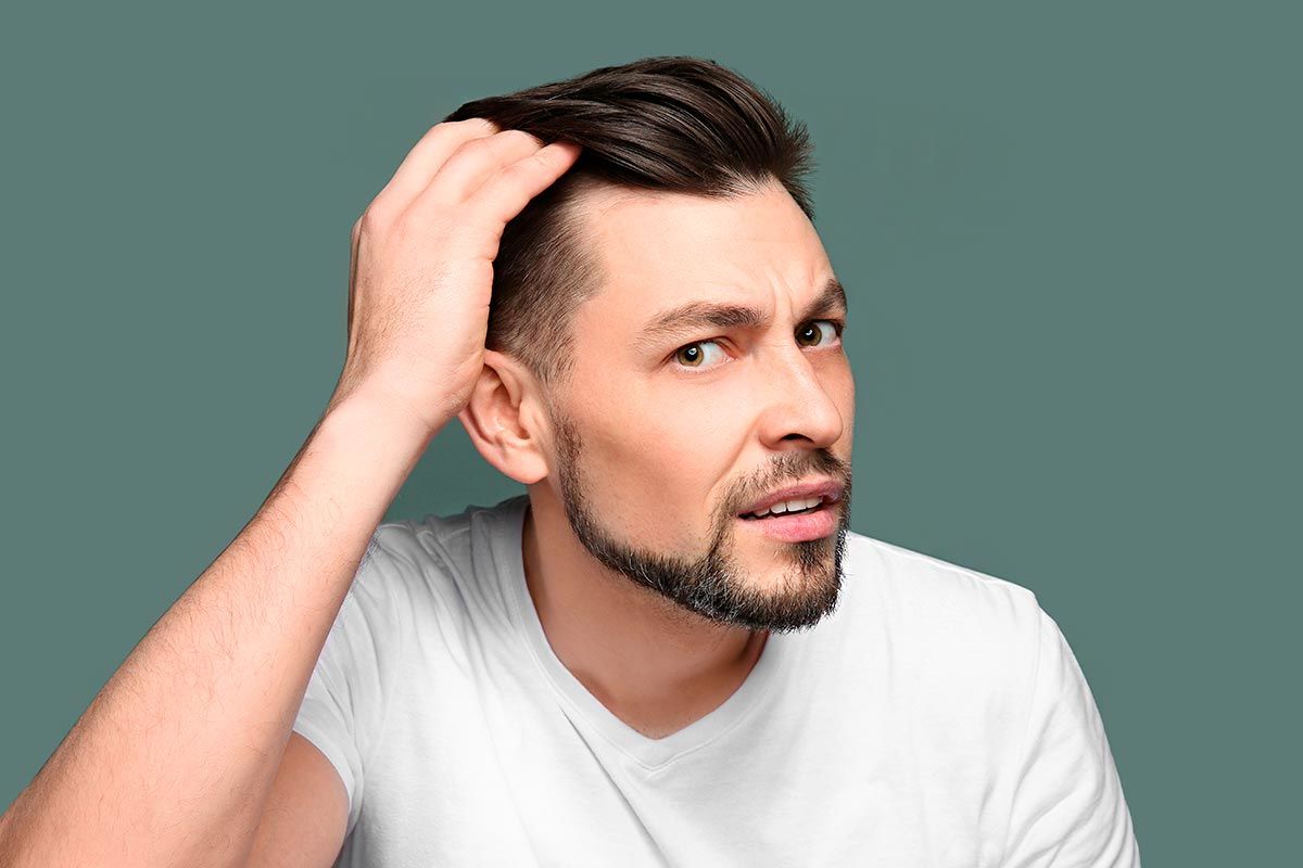 Here’s What You Must Do To Stop A Receding Hairline