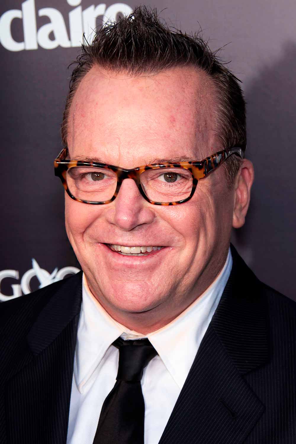 15 Haircuts For Balding Men Celebs Rock Today